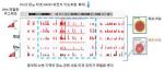 한국인 당뇨병 관련 11종 후성유전체 지도 공개